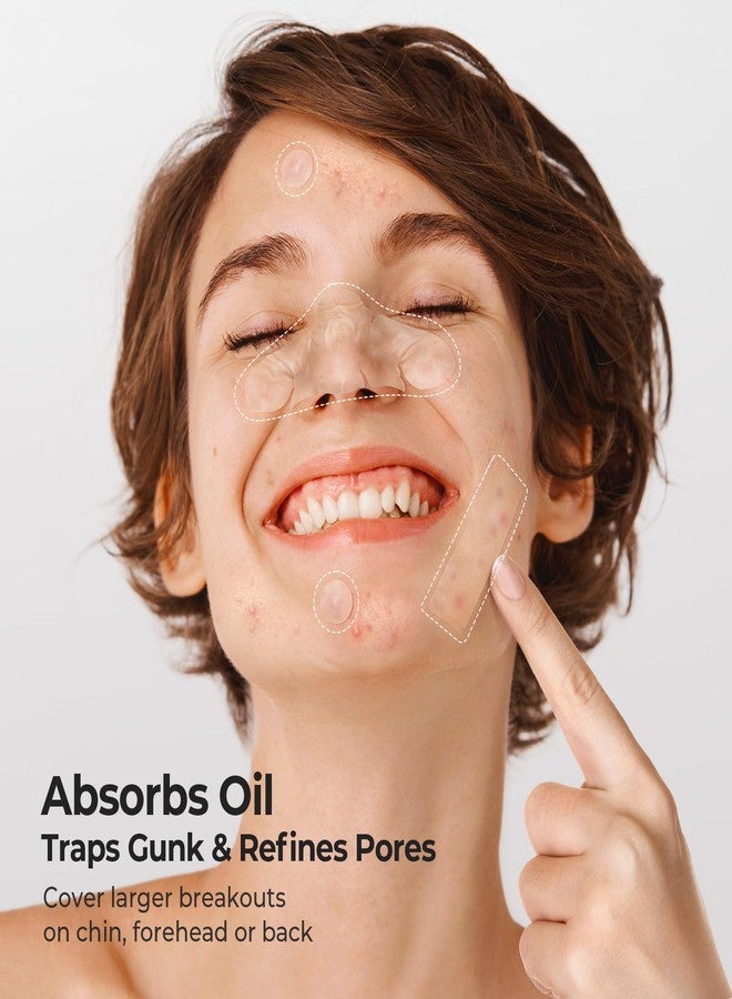 تي كيه تي كيه لصقات الأنف الهيدروكولويدية من TKTK، شرائط مسام الأنف XL 91 × 48 مم، لصقات حب الشباب الكبيرة الهيدروكولويدية للوجه، تغطي عيوب البثور وتمتص الزيوت (مُصممة لتناسب شكل الأنف، شريط، نقاط 5 أحجام 112 قطعة) - Image 3